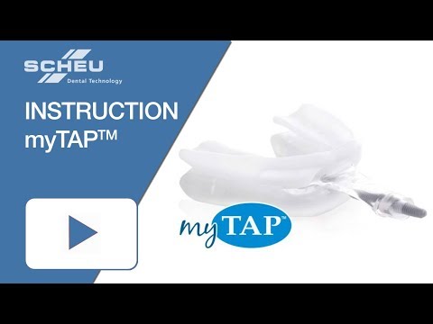 myTAP Kit